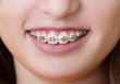 Dental visit