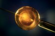 In vitro fertilization.
