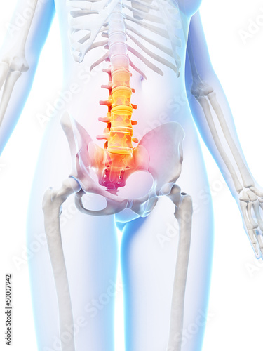 Illustration: 3d rendered illustration of a painful lower spine 3d rendered illustration of a painful lower spine