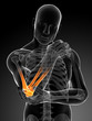 3d rendered illustration of pain in the elbow