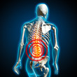 Illustration: human back pain rückenschmerzen human back pain rückenschmerzen