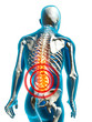 Illustration: human back pain rückenschmerzen freisteller human back pain rückenschmerzen freisteller