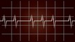 EKG, Diagnose, Pulsieren, Bewegung,