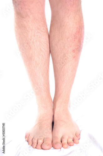 Photo: Skin Disease Skin Disease
