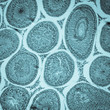 egg cell oocyte in ovary tissue