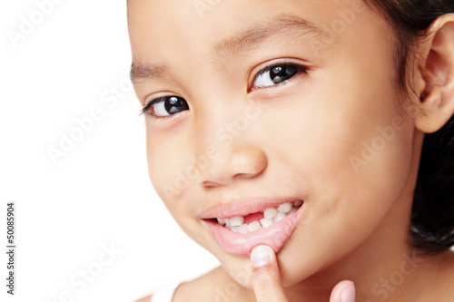 Photo: My Missing Teeth My Missing Teeth