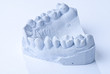 dentales Gipsmodell