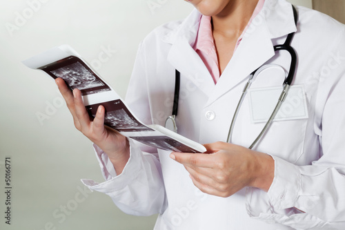 Photo: Radiologist Holding Ultrasound Print Radiologist Holding Ultrasound Print