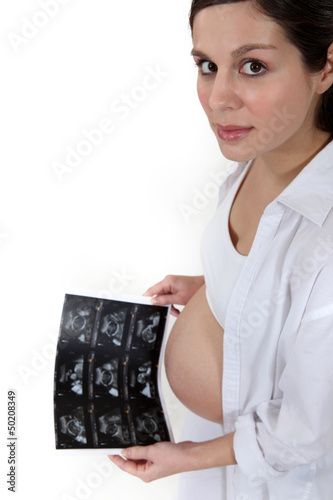 Photo: Pregnant woman holding x-ray image Pregnant woman holding x-ray image