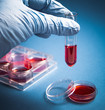 blood test - medical diagnostic laboratory