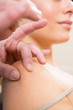 Doctor hands acupuncture needle pricking on woman