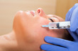 Foto: Anti aging facial mesotherapy syringe on woman face Anti aging facial mesotherapy syringe on woman face