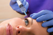 Foto: Anti aging facial mesotherapy syringe on woman face Anti aging facial mesotherapy syringe on woman face