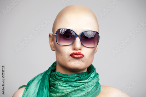 Photo: die Glatze die Glatze