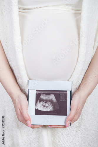 Photo: young pregnant woman looking at ultrasound image young pregnant woman looking at ultrasound image