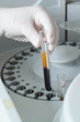 Woman loading samples in biochemical analyzer