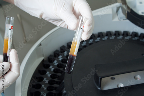 Photo: Woman loading samples in analyzer Woman loading samples in analyzer