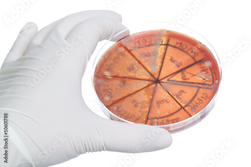 Photo: Hand in clove with petri dish Hand in clove with petri dish