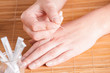 Acupuncture