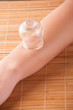 Cupping-glass on acupuncture