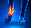 Ankle pain - detail