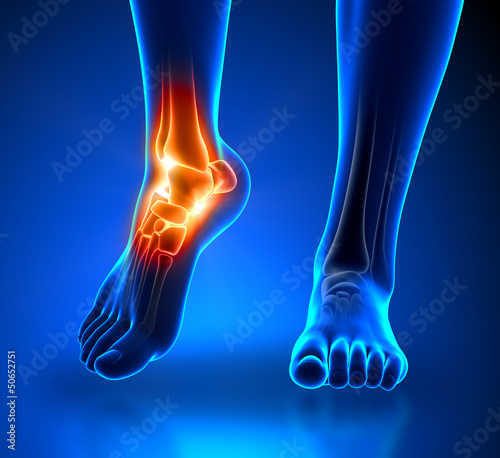 Illustration: Ankle pain - detail Ankle pain - detail