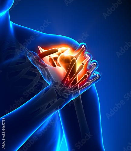 Illustration: Shoulder pain - detail Shoulder pain - detail