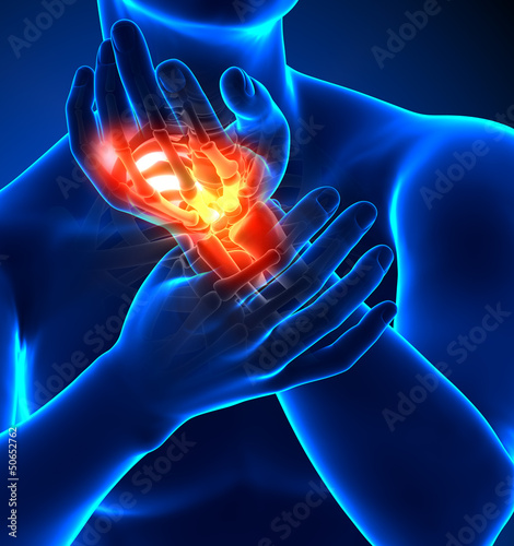 Illustration: Wrist pain - detail Wrist pain - detail