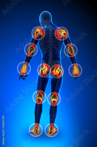 Illustration: Joints pain - full figure Joints pain - full figure