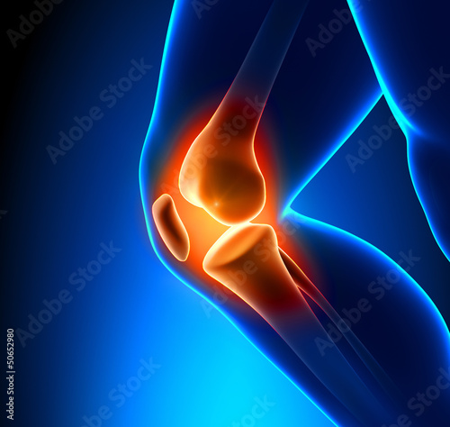 Illustration: Painful Knee Close-up Painful Knee Close-up