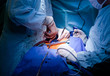 Doctors operating on patient