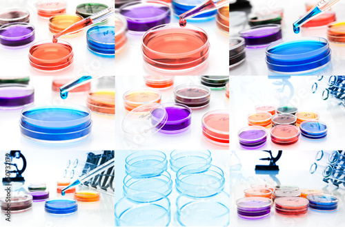 Photo: Collage (set) of petri dishes.lab tools. Collage (set) of petri dishes.lab tools.