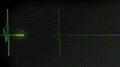 Normal heartbeat pulse monitored on a hospital EKG
