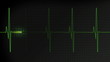 Fast heartbeat pulse monitored on a hospital EKG