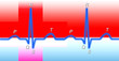Electrocardiogram