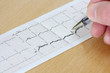 Arrhythmia