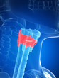 thyroid cartilage