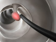 3d rendered illustration of a polyp removal