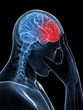 3d rendered conceptual illustration of head pain