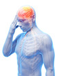 3d rendered conceptual illustration of head pain