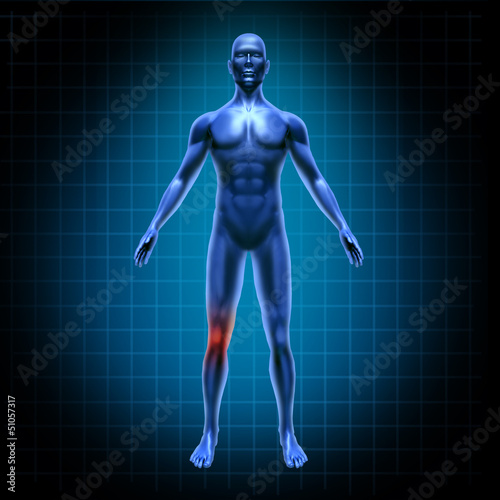 Illustration: Human knee pain Human knee pain
