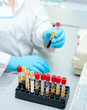 test tubes with blood
