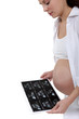Pregnant woman looking at x-ray of baby