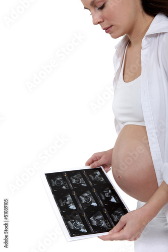 Photo: Pregnant woman looking at x-ray of baby Pregnant woman looking at x-ray of baby