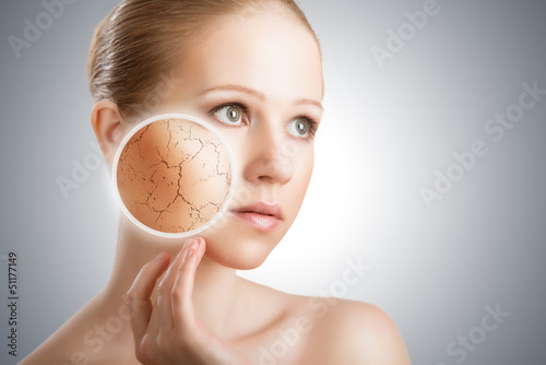 Photo: concept of cosmetic skin care. face of young woman with dry ski concept of cosmetic skin care. face of young woman with dry ski
