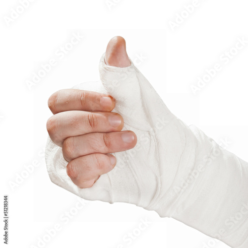 Photo: Broken arm in a cast. Fingers show the character all right Broken arm in a cast. Fingers show the character all right