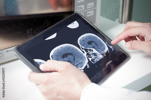 Photo: doctor examining a brain cat scan on a digital tablet doctor examining a brain cat scan on a digital tablet