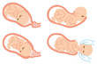 Childbirth Illustration
