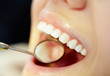 Mouth care