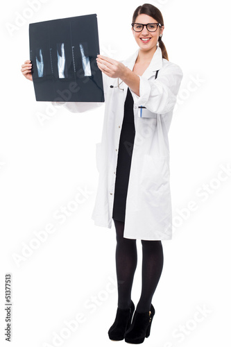 Photo: Female doctor reviewing patient's x-ray report Female doctor reviewing patient's x-ray report